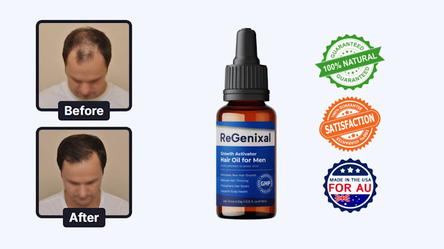 ReGenixal Hair Recover get