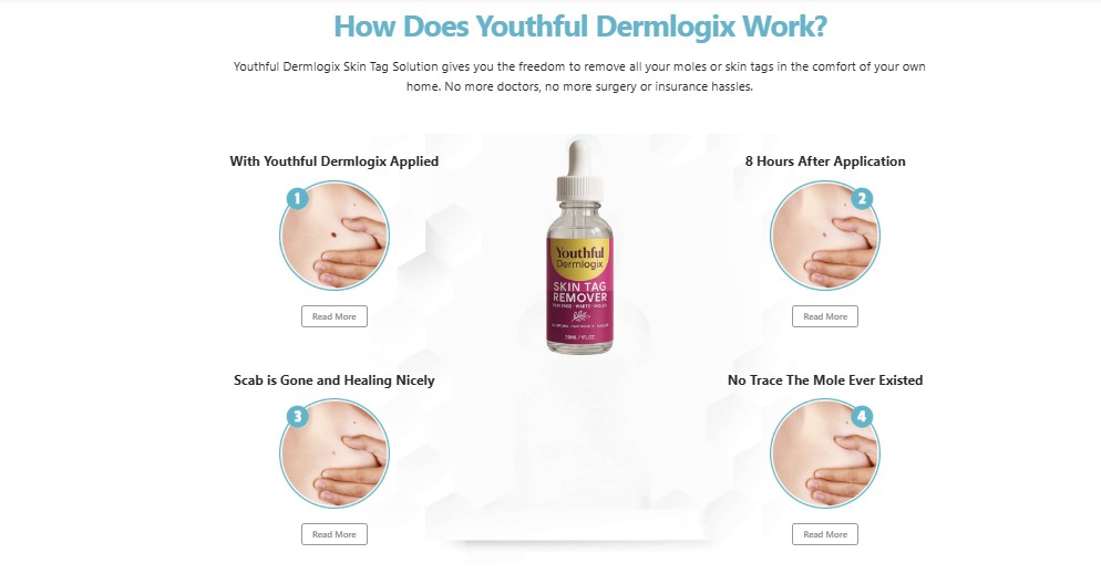 Youthful Dermlogix Skin Tag Remover