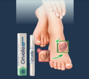 Orivelle Fungus Pen Ireland – Does This Anti-Fungal Pen Really Work?