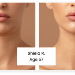Anti Wrinkle Cream Reviews