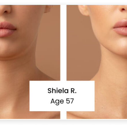Anti Wrinkle Cream Reviews