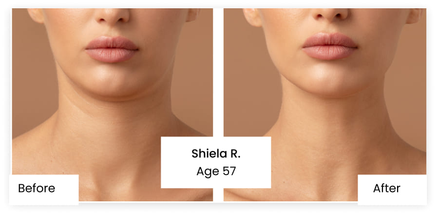 Anti Wrinkle Cream Reviews