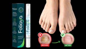 Foliaya Anti-Fungal Pen – Is This Nail Care Pen Effective?